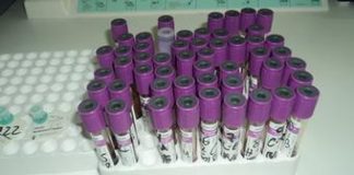 Aumenta número de pessoas infectadas pelo HIV em Cabo Delgado