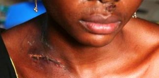 Aumentam casos de violência doméstica contra a mulher em Nampula