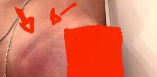 Maputo: Falta de campanhas sobre cancro da mama preocupa jovens