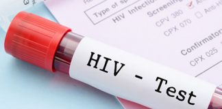 Mais de dois milhões de moçambicanos vivem com o HIV: Raparigas dos 15 aos 18 anos constituem grande parte Em Mocambique, pelo menos 13% da populacao vive com HIV/SIDA
