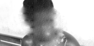 Outra vez Namicopo? Vizinha queima vizinha com água quente por causa de fogão de cozinha