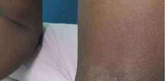 Jovem queima parceiro com recurso a água quente para evitar ser expulsa de casa após o marido descobrir um “par de chifres”