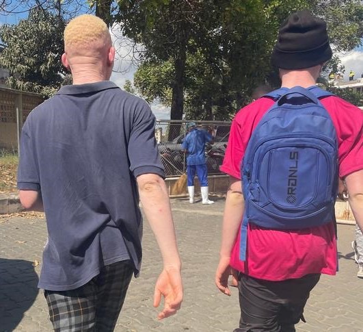 Um alívio para os albinos em Nampula : “Amor à Vida” não registou casos de sequestro no presente ano