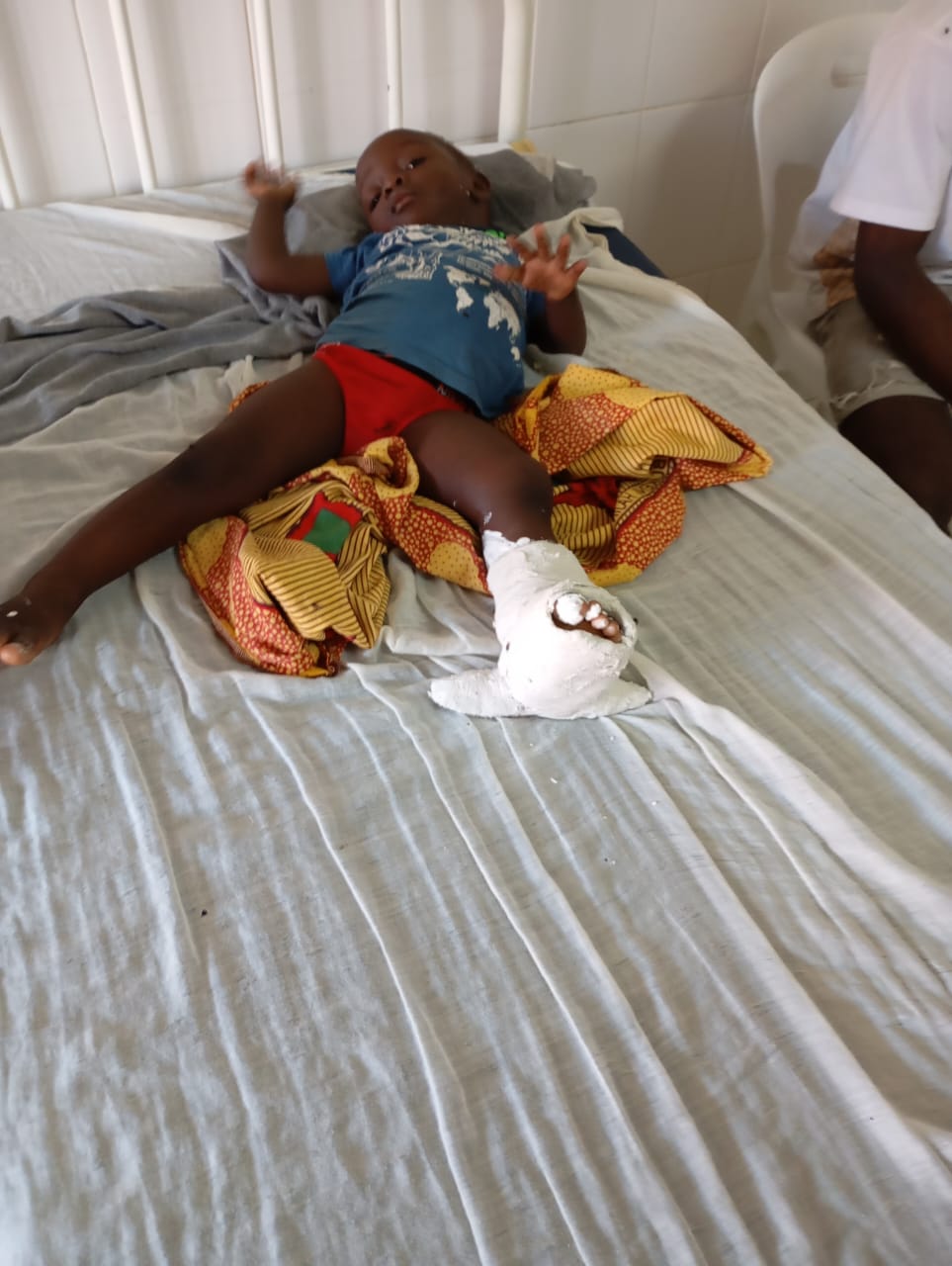 Mesmo com crianças no leito hospitalar :PRM nega ter atingido crianças durante manifestações em Nampula