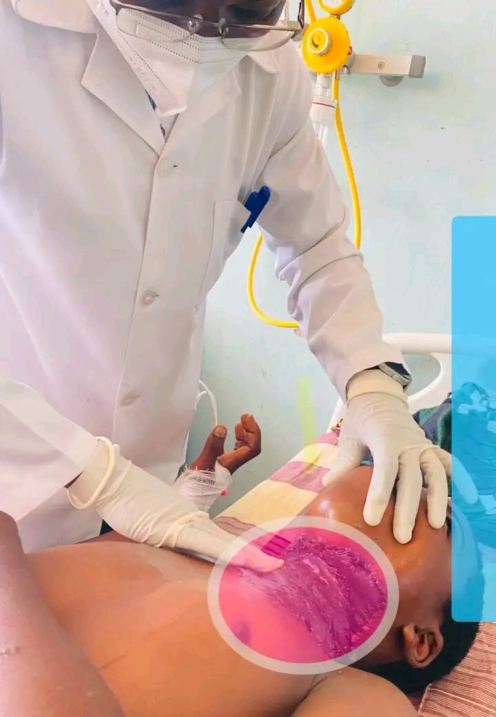 Jovens médicos do HCN continuam a fazer sucesso em cirurgias complexas Jovens médicos do HCN continuam a fazer sucesso em cirurgias complexas